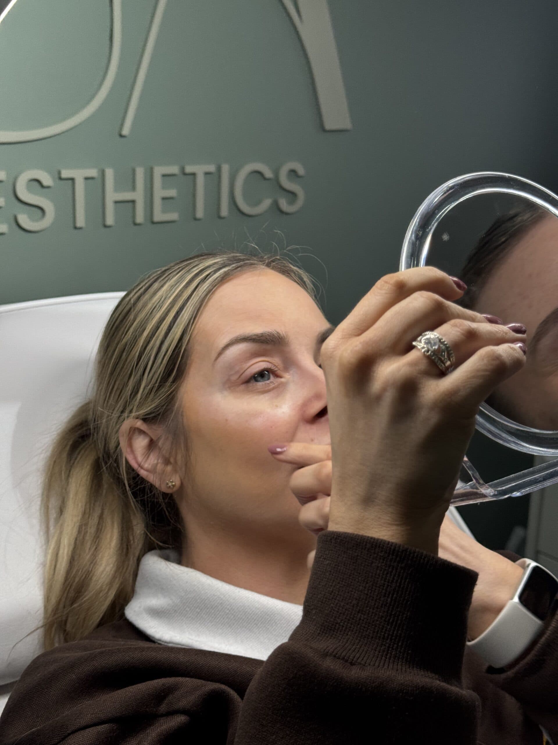 Nurse administering a polynucleotide skin treatment injection to a client's cheek